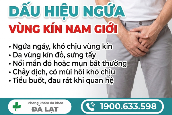Hình ảnh minh họa
